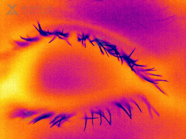 微距鏡頭清晰監(jiān)測(cè)皮膚毛發(fā)