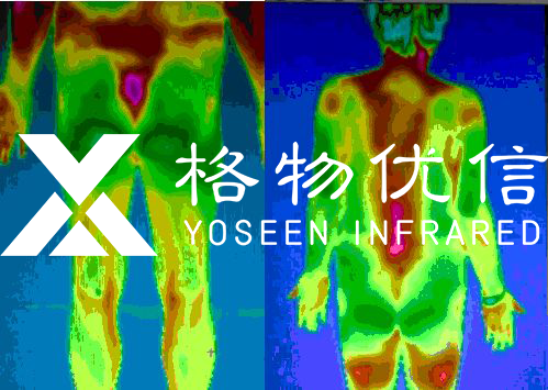 中醫(yī)診療可視化數(shù)字化紅外熱像儀的全面應用